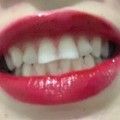 Отзыв о Отбеливающие полоски Dr.Kogel: мой первый опыт отбеливания